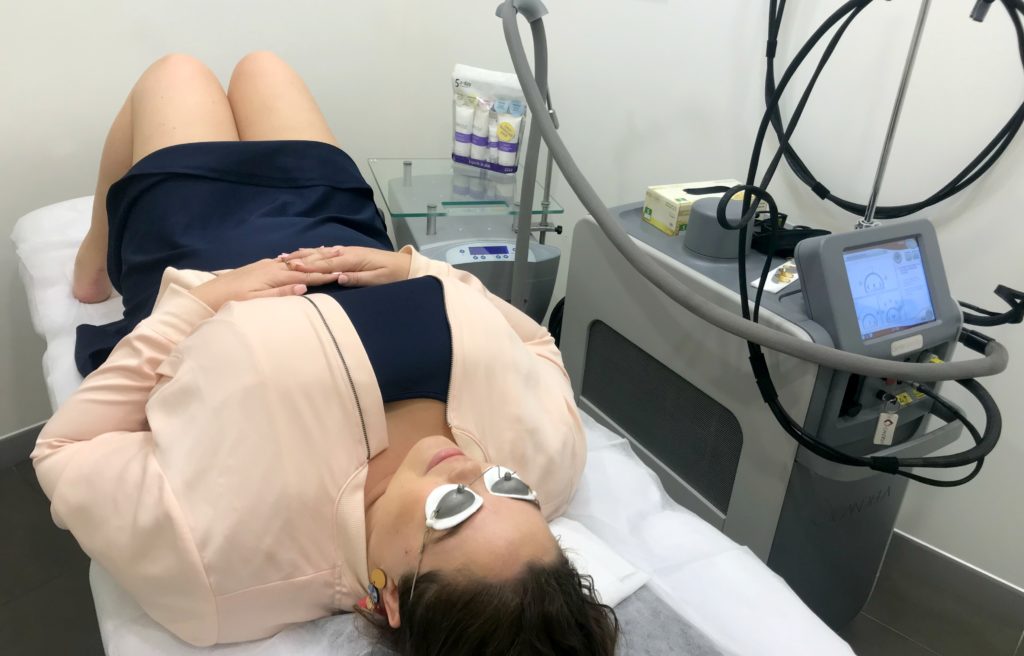 plus size, curvysam, laser hair removal